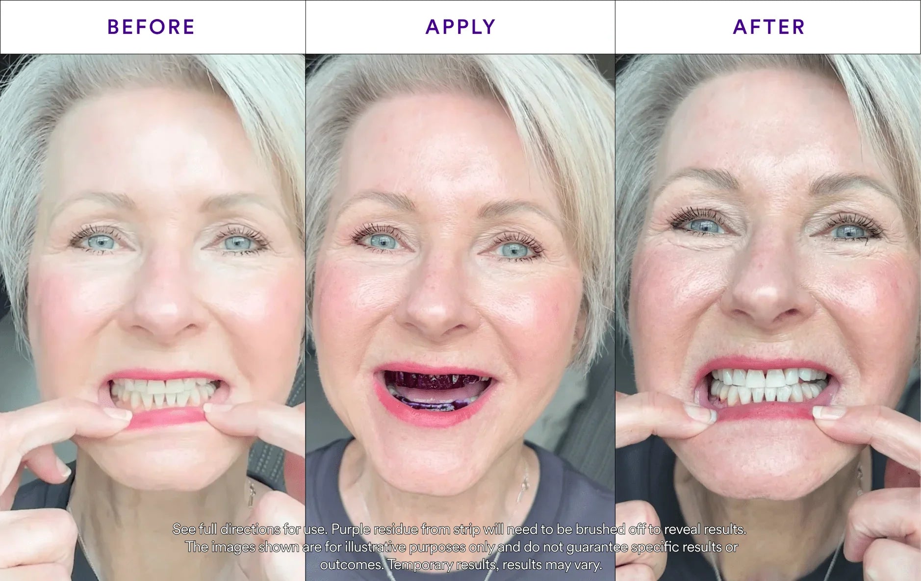hismileteethwhitening.it.com