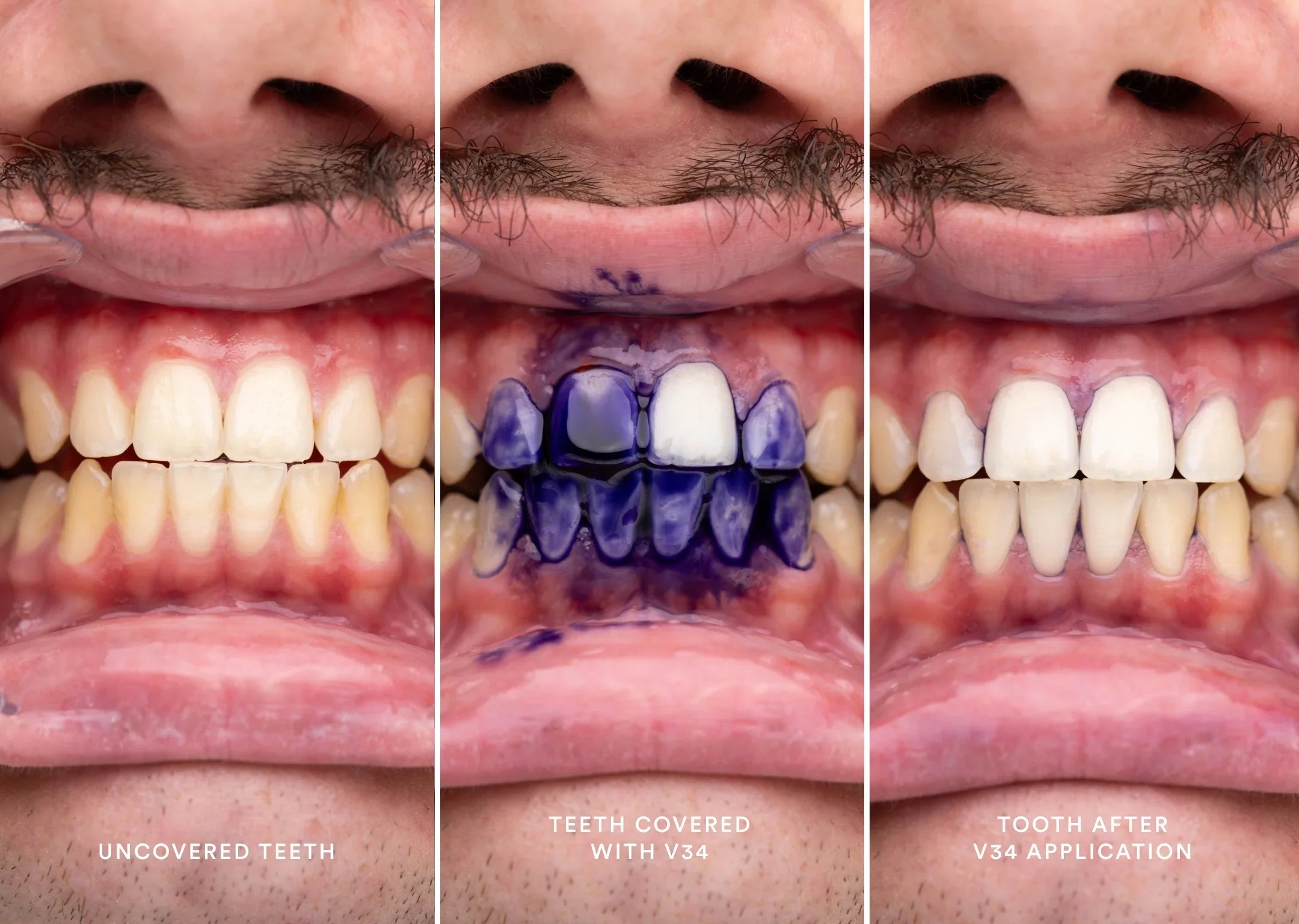 hismileteethwhitening.it.com
