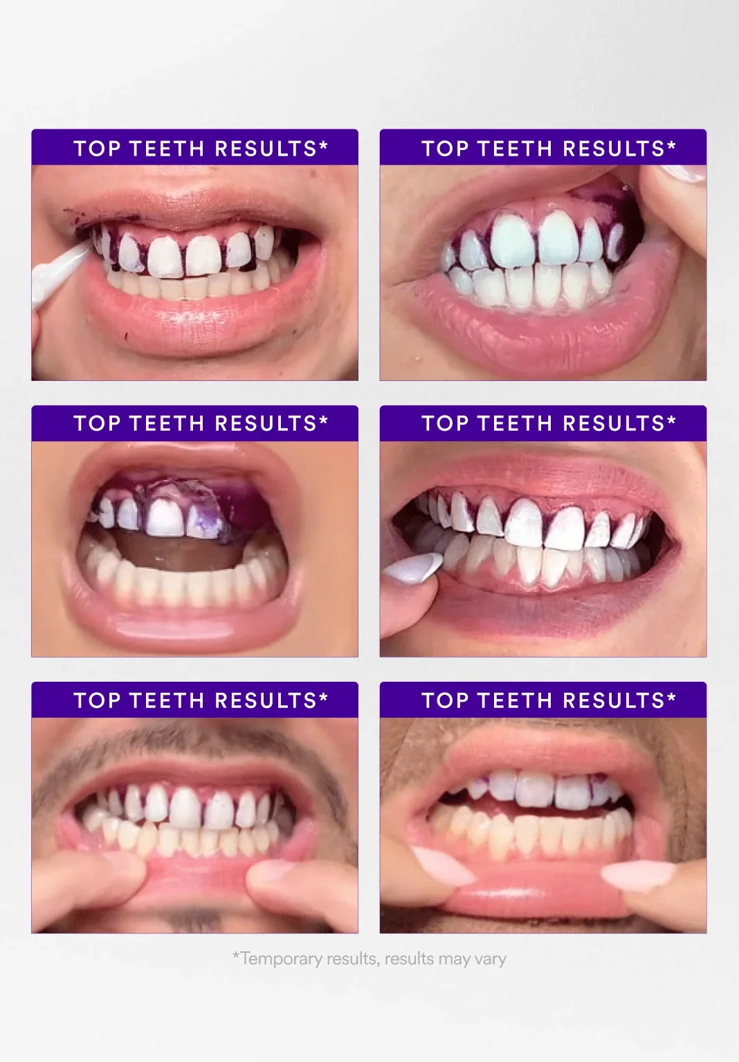 hismileteethwhitening.it.com