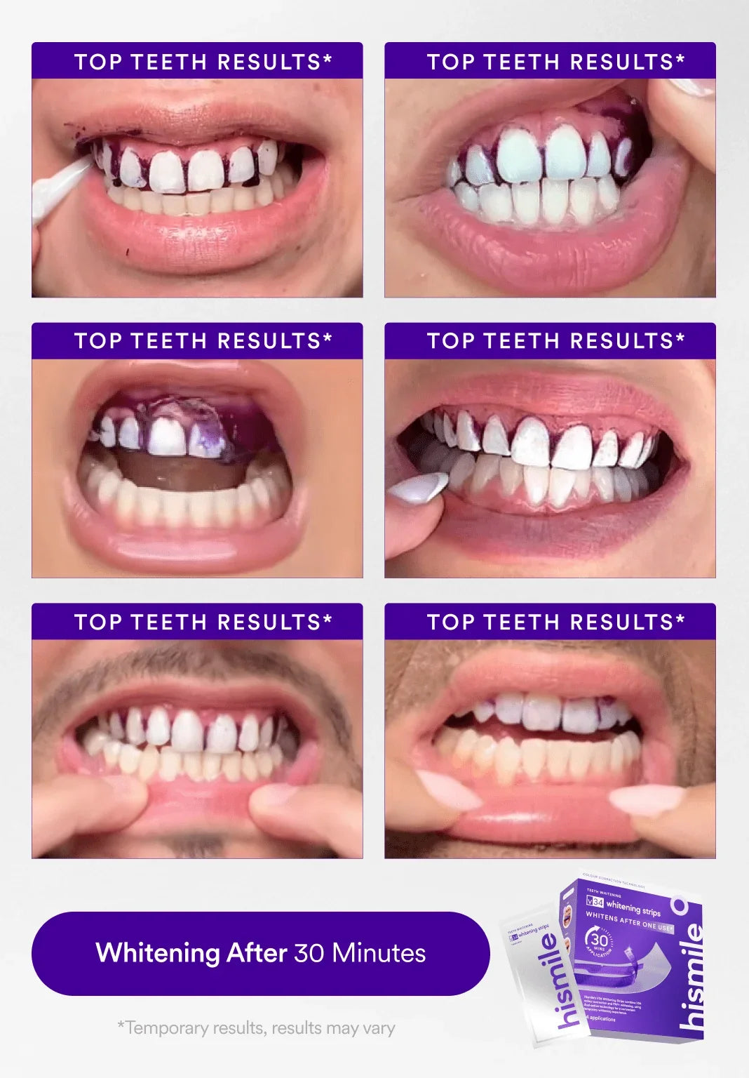 hismileteethwhitening.it.com