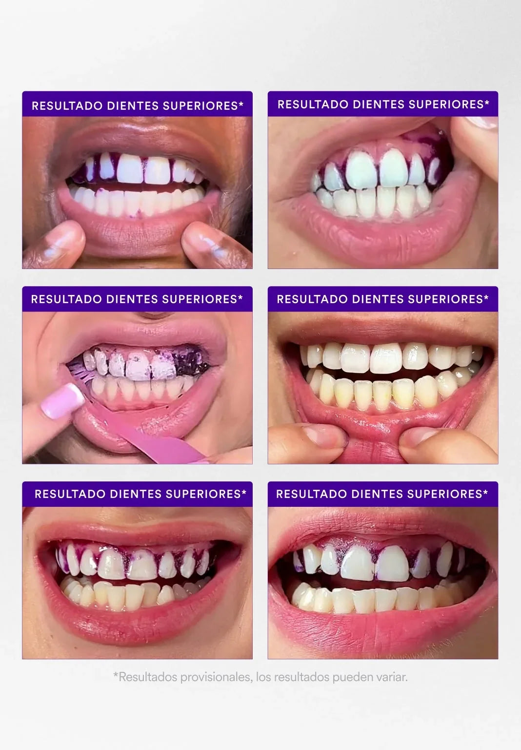 hismileteethwhitening.it.com