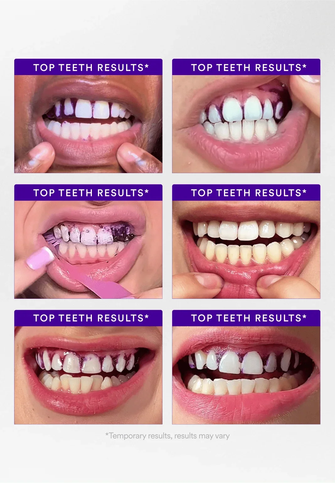 hismileteethwhitening.it.com