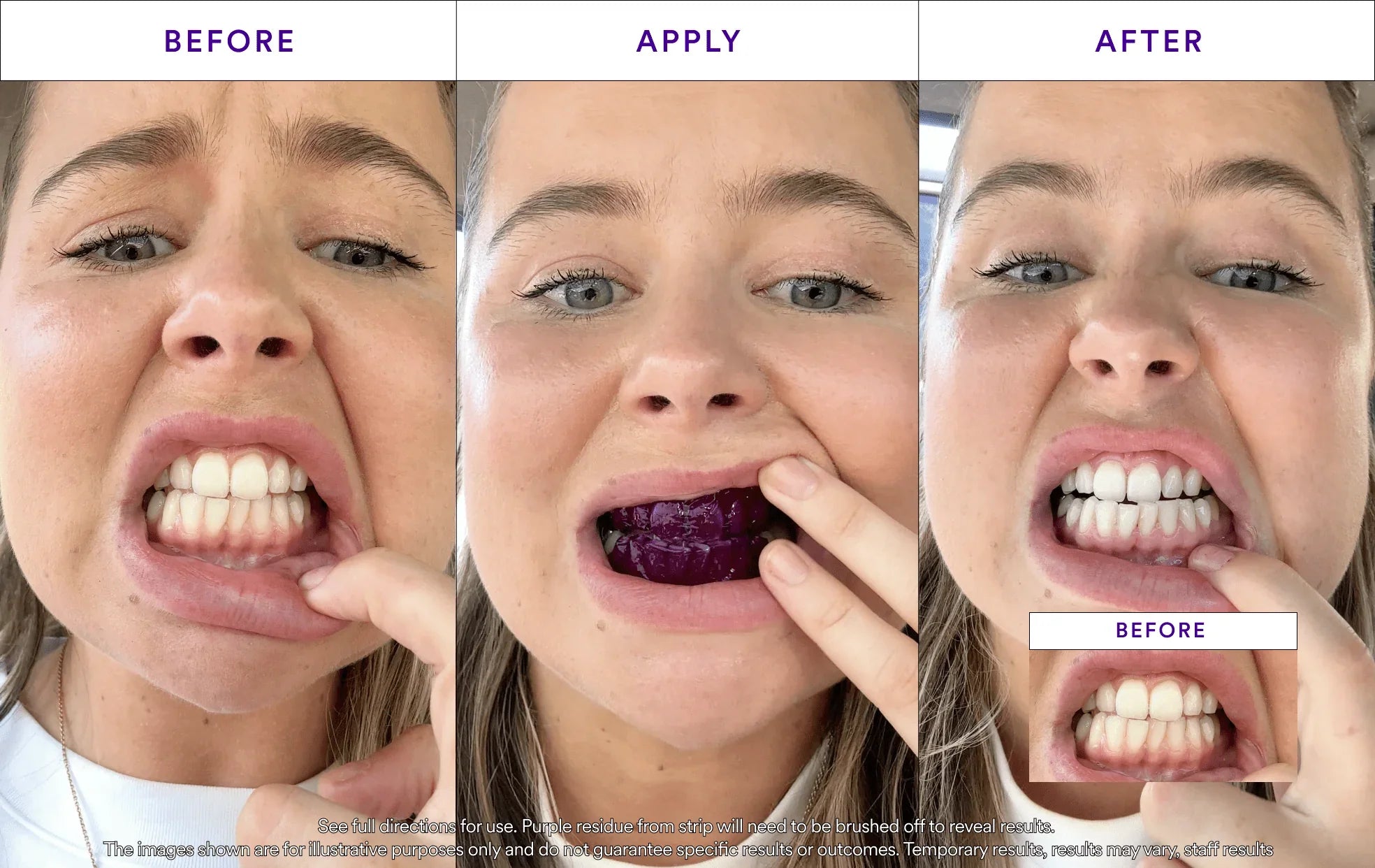 hismileteethwhitening.it.com